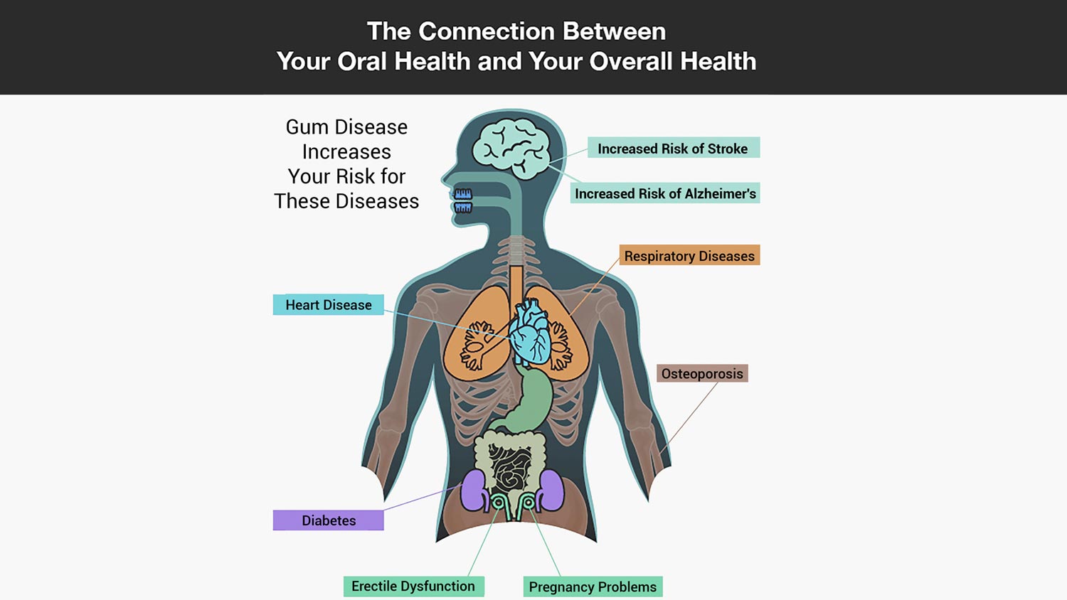 Connection between oral health and overall health