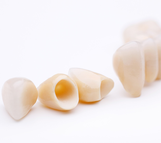 Mansfield Dental Crowns and Dental Bridges