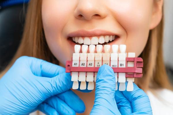 How Can Dental Veneers Reshape Teeth?