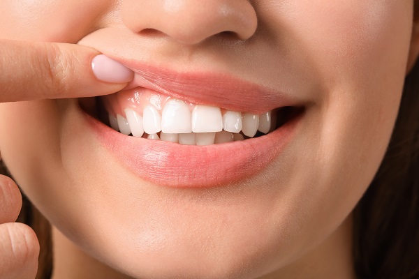 Can Gum Disease Be Cured?