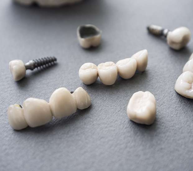 Mansfield The Difference Between Dental Implants and Mini Dental Implants