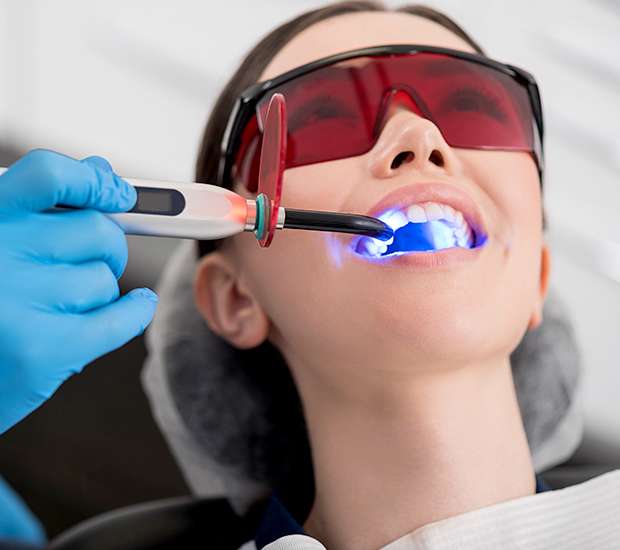 Mansfield Professional Teeth Whitening